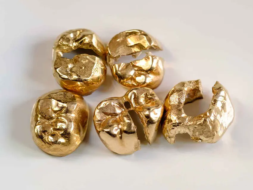 Juwelier-Maximilian-Landshut-Zahngold